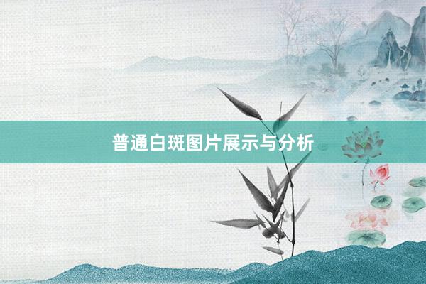 普通白斑图片展示与分析
